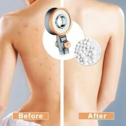 MIYA Cabezales De Ducha Turbo De Doble Cara De 3 Cabezas Con Filtro De Algodón PP - Ducha De Mano De Alta Presión Que Ahorra Agua - Adecuado Para Baños De Agua Dura O Blanda -Angebote Rasenmäher & Zubehör Store 60767634 5